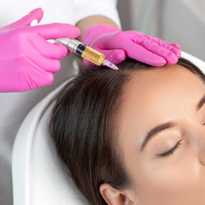 Hair Loss Treatment at The Face skin clinic, Billericay, Essex