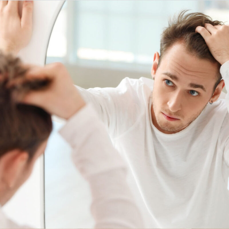Hair Loss Treatments at The Face skin clinic, Billericay, Essex